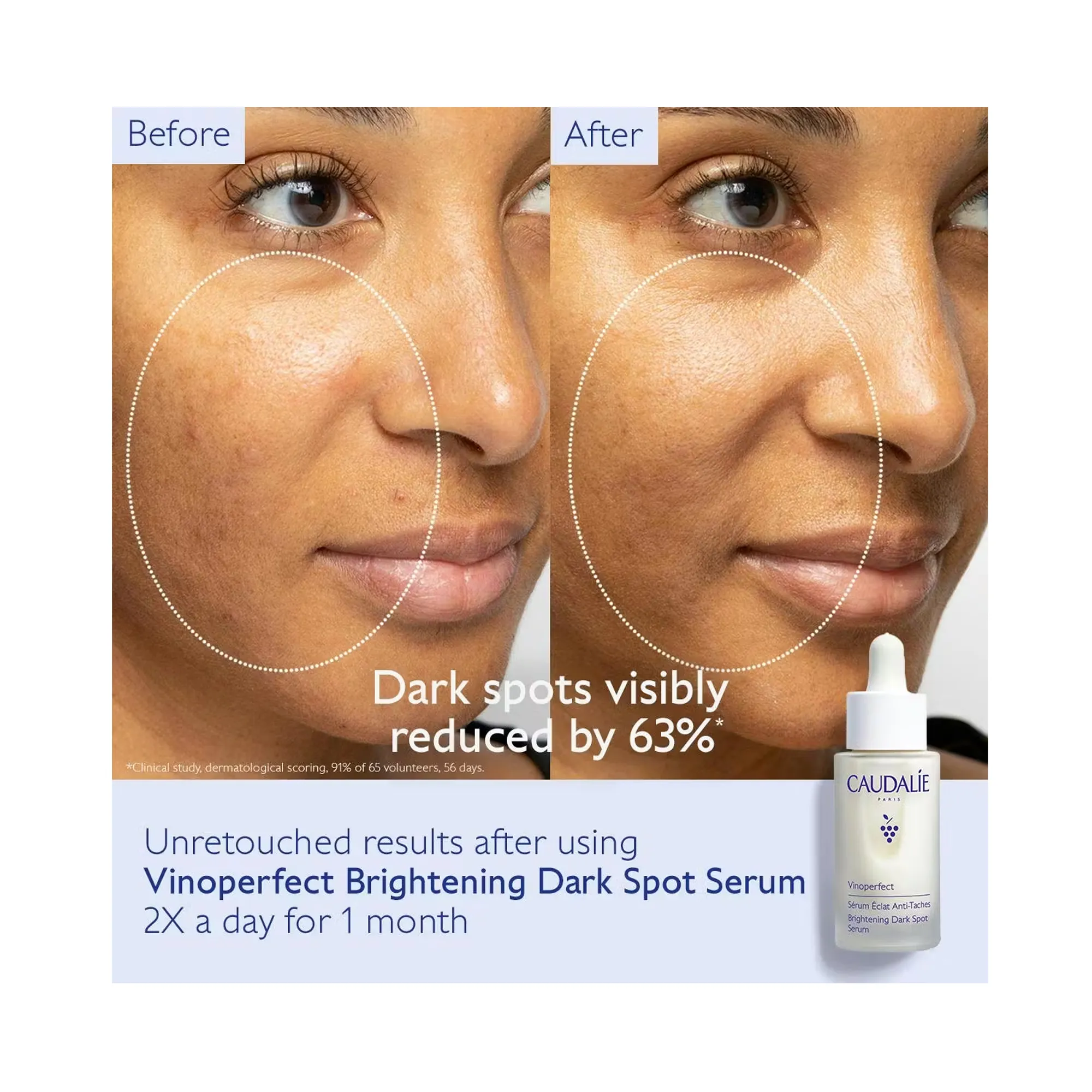 Caudalie Vinoperfect Brightening Dark Spot Serum