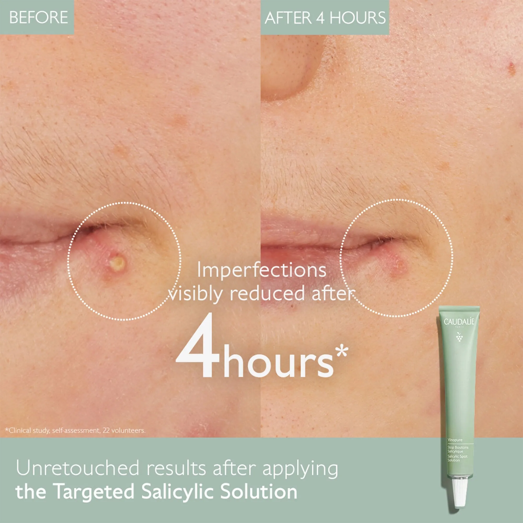Caudalie Vinopure Spot Solution With Salicylic Acid