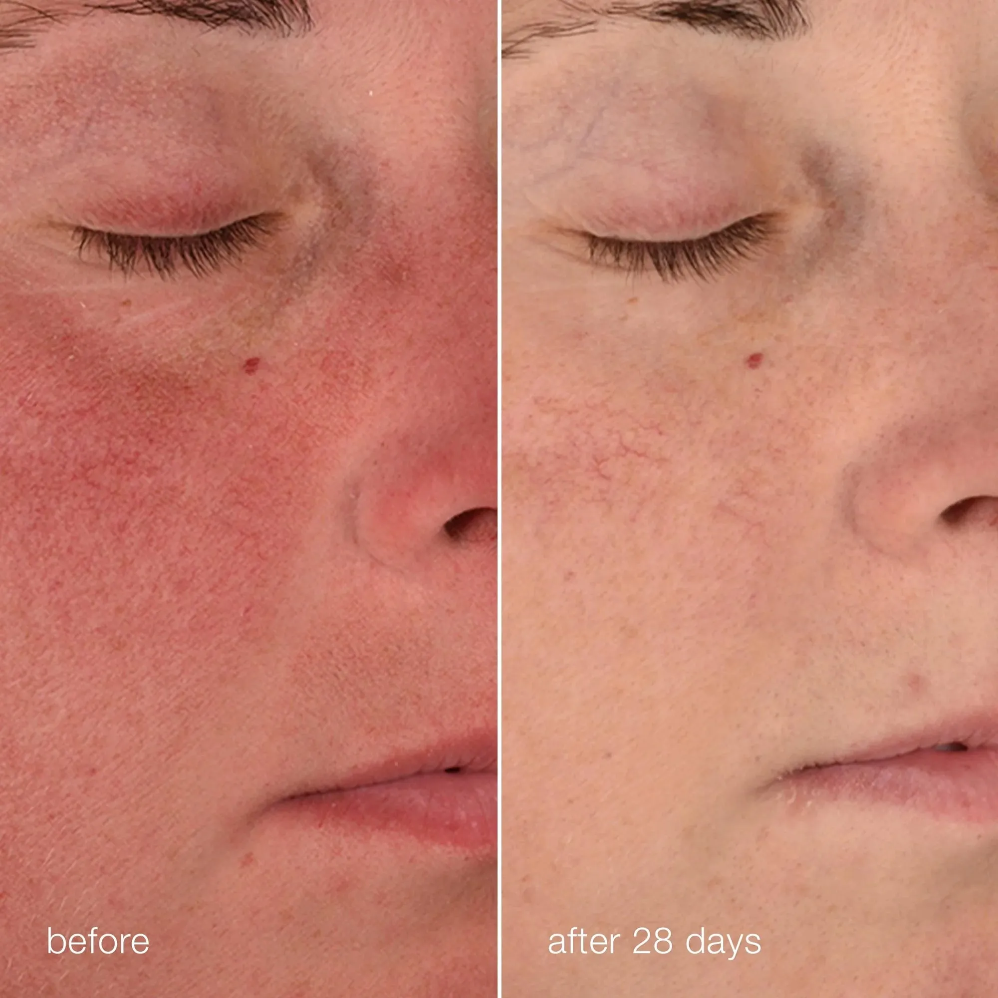 Dermalogica Stabilizing Repair Cream