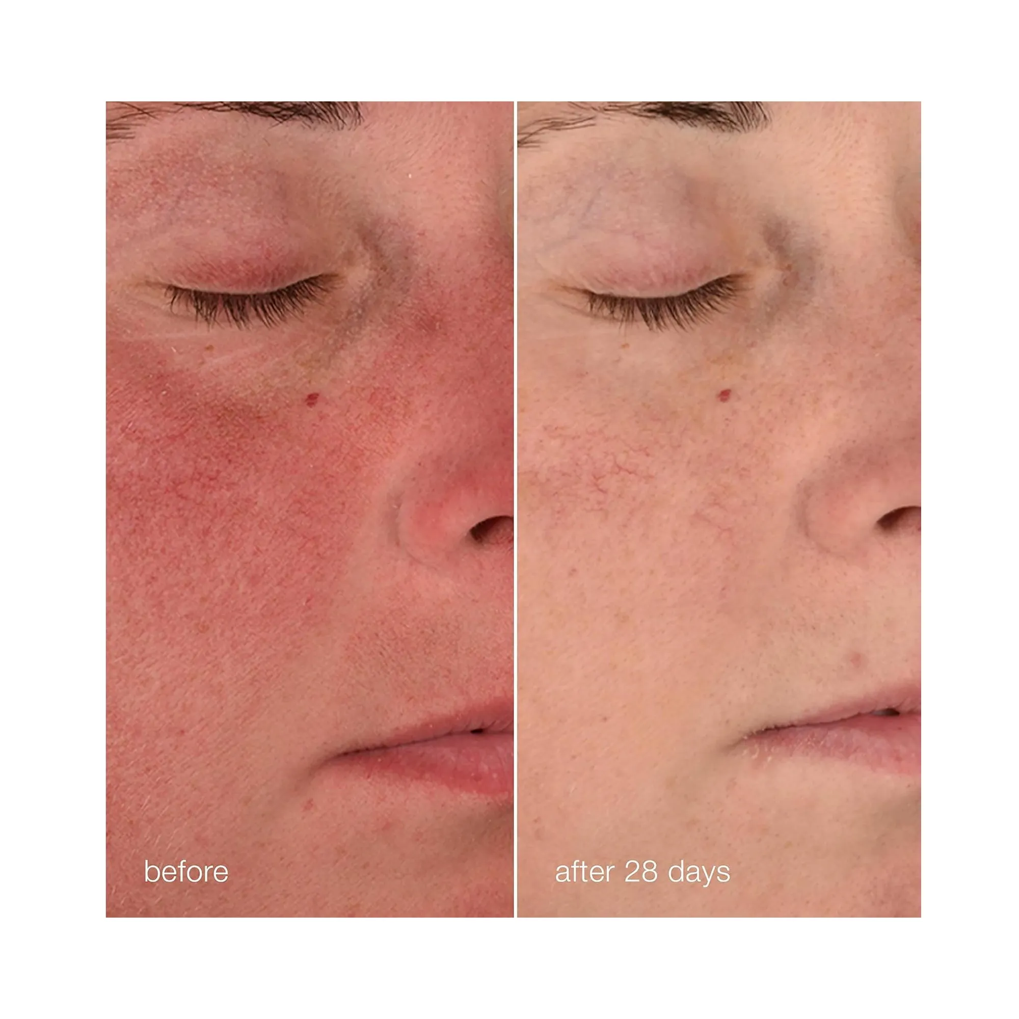 Dermalogica Stabilizing Repair Cream