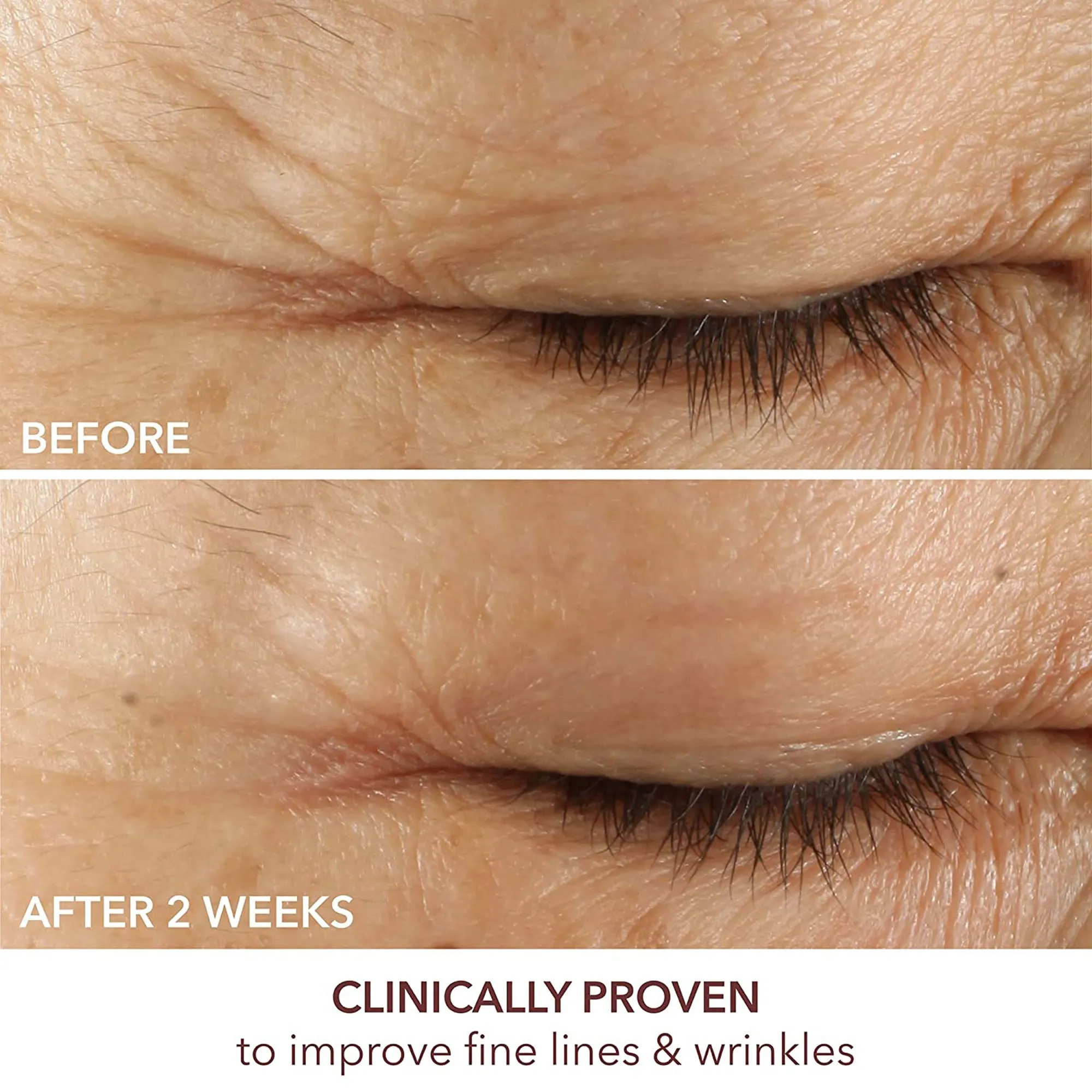 Dr. Dennis Gross Advanced Retinol   Ferulic Triple Correction Eye Serum