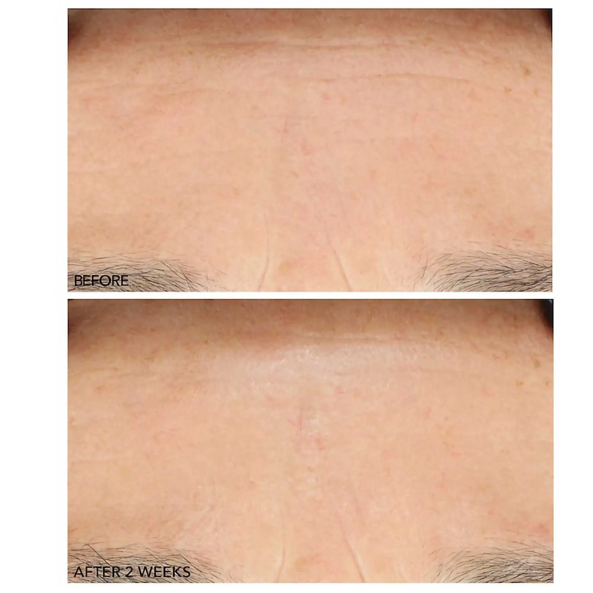 Dr. Dennis Gross Alpha Beta Advanced Liquid Peel 2-step