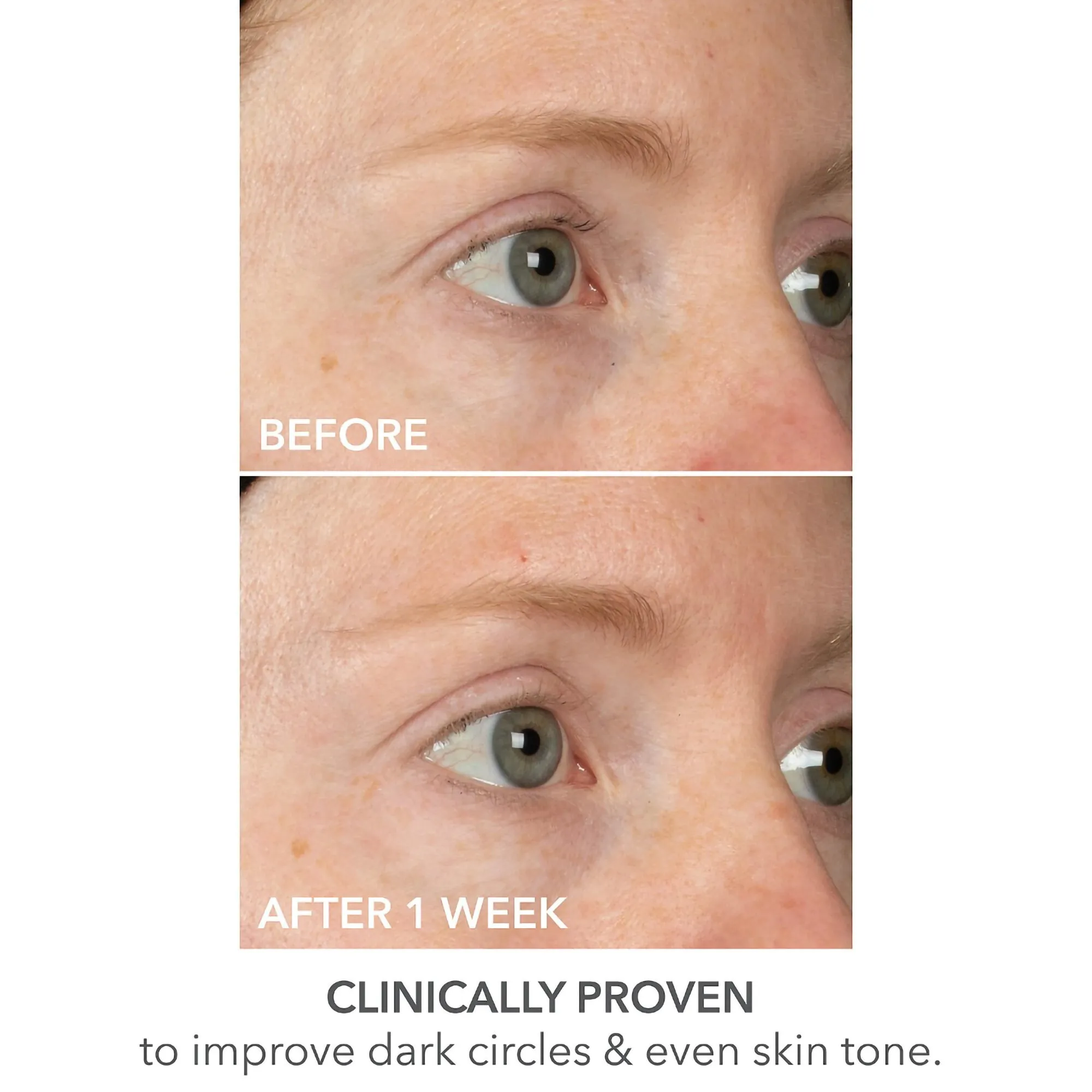 Dr. Dennis Gross DermInfusions Lift   Repair Eye Mask
