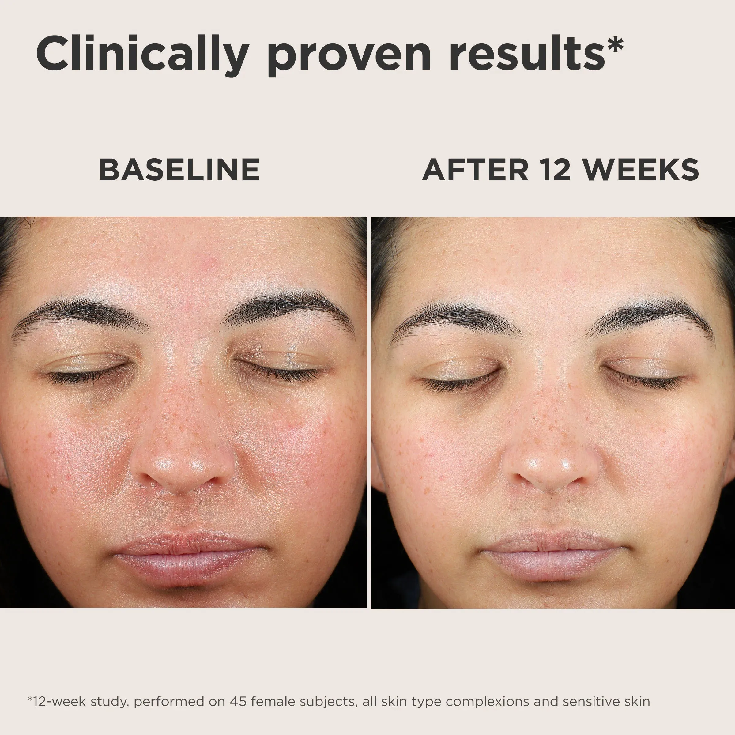 EltaMD UV Skin Recovery Broad Spectrum SPF 50 Face Sunscreen