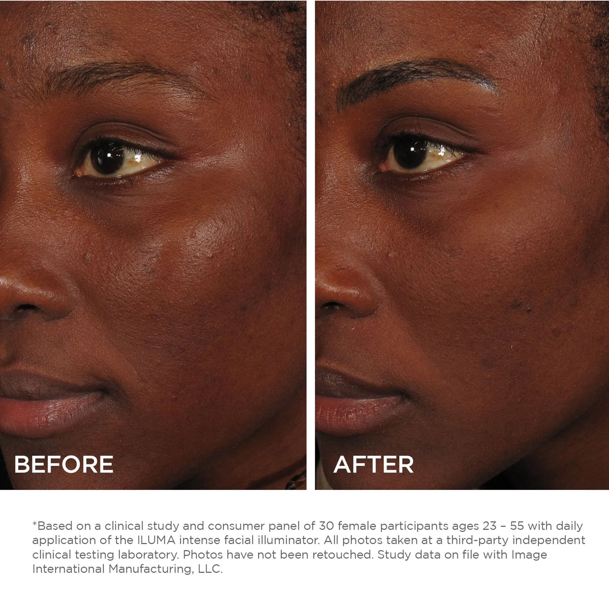 Image Skincare Iluma Brightening Intense Facial Illuminator