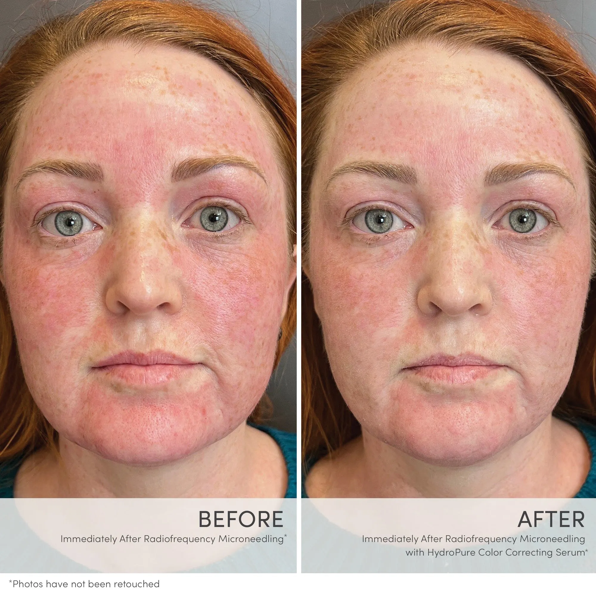 Jane Iredale HydroPure Color Correcting Serum