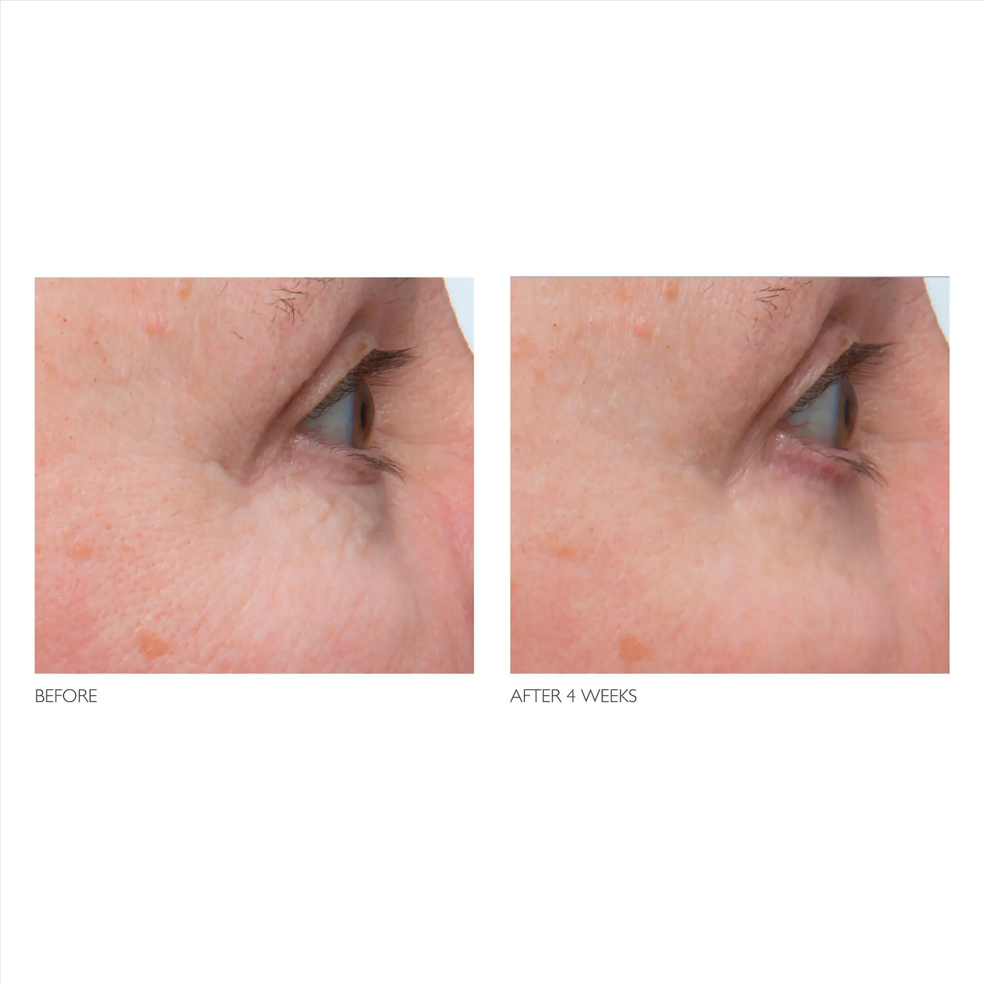 Kate Somerville   Retinol Firming Eye Cream