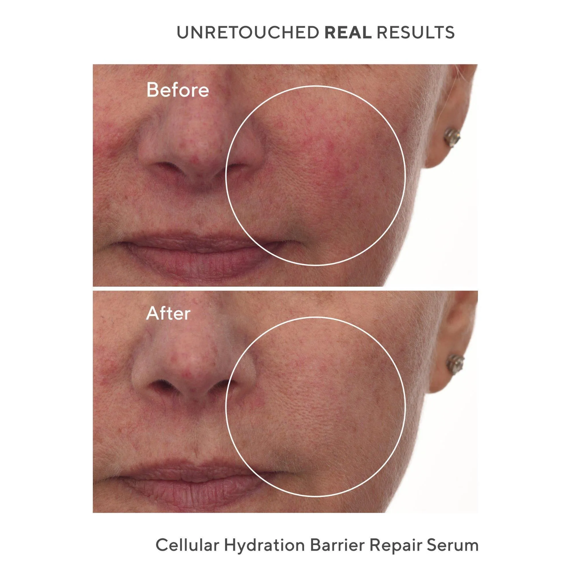 Murad Cellular Hydration Repair Serum
