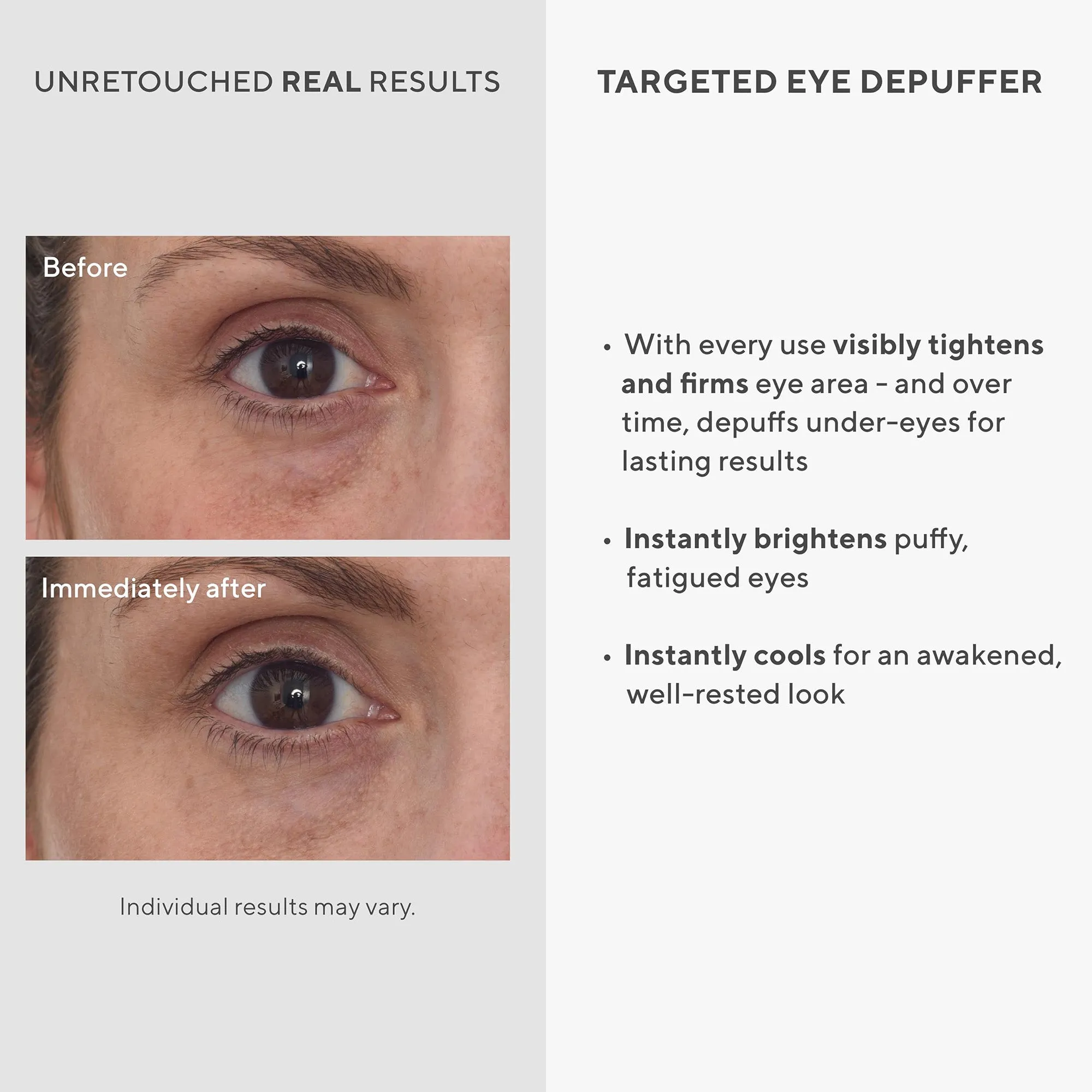 Murad Environmental Shield Targeted Eye Depuffer