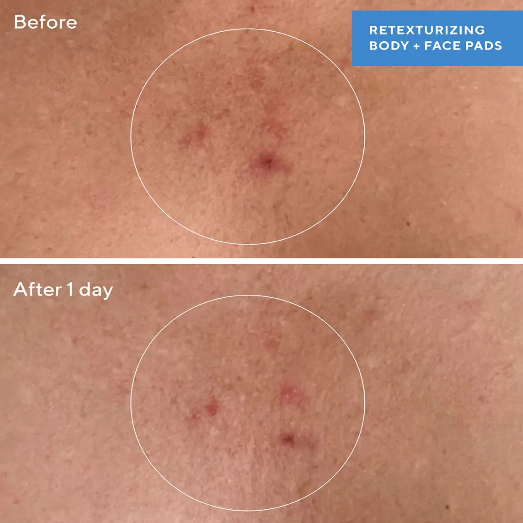 Murad Retexturizing Body Pads