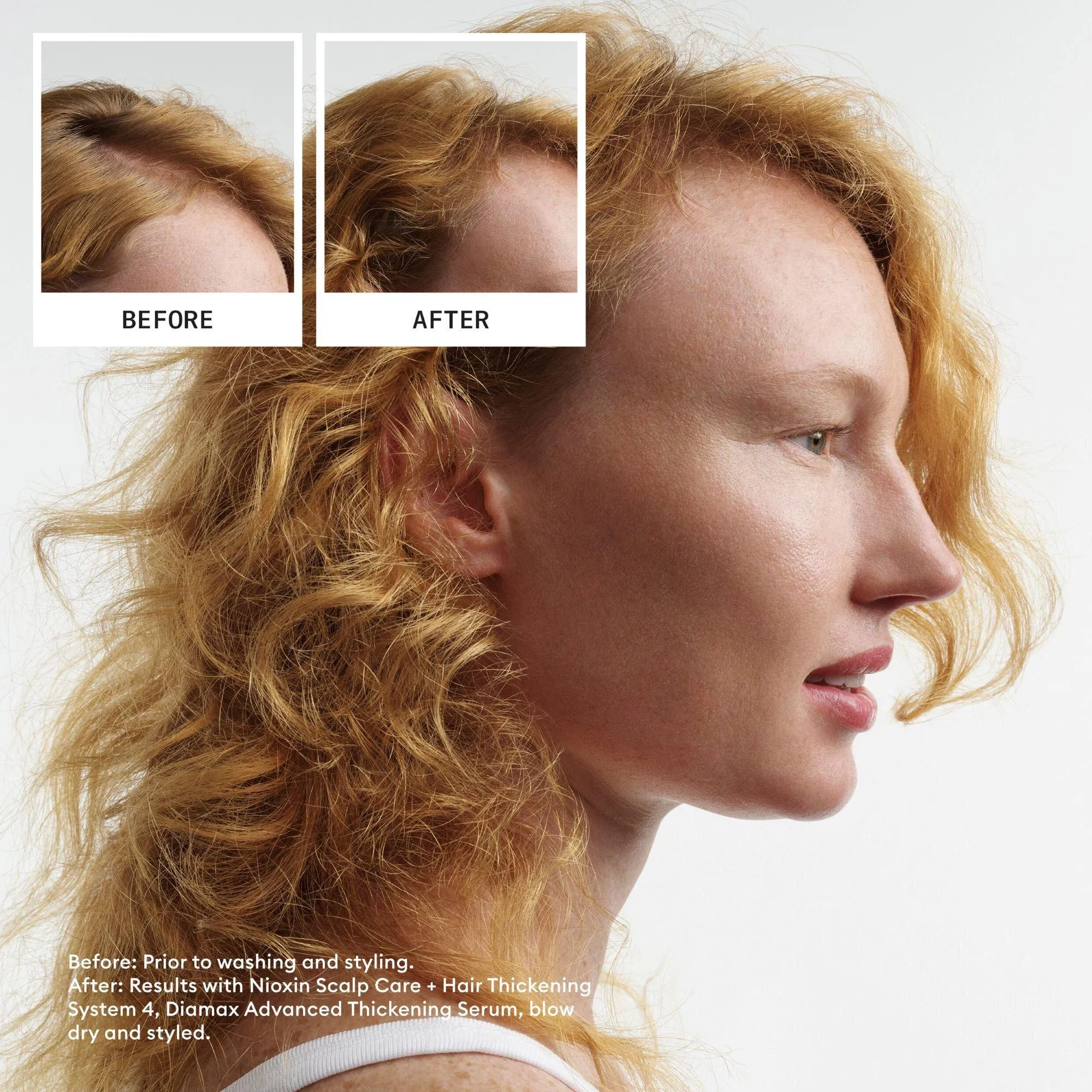 Nioxin System 4 Scalp Care   Hair Conditioner