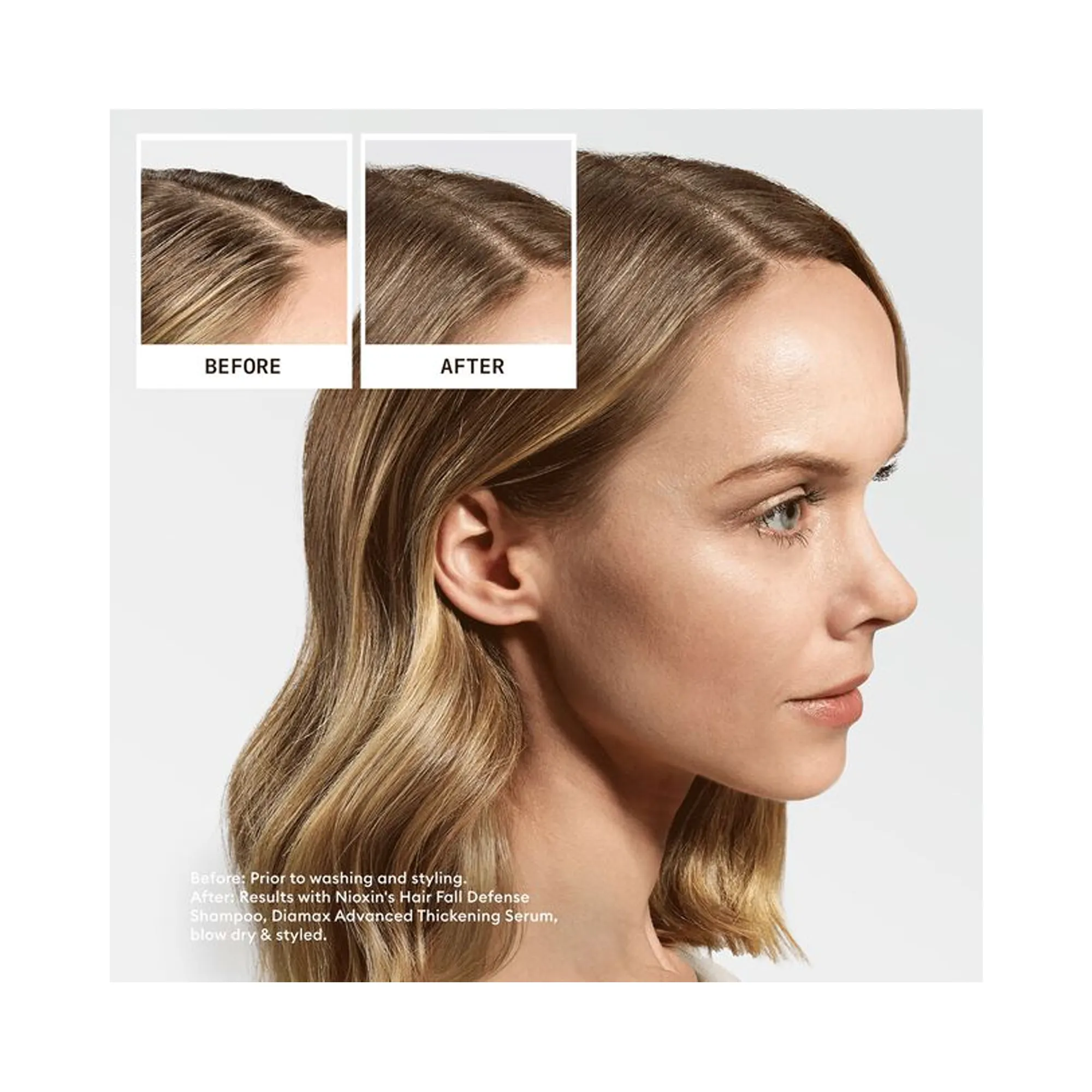 Nioxin Ultimate Power Hair Fall Defense Shampoo