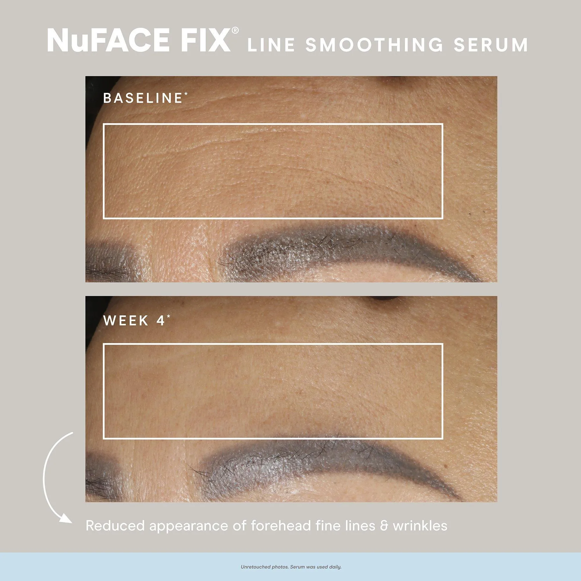 NuFace Fix Smoothing Serum
