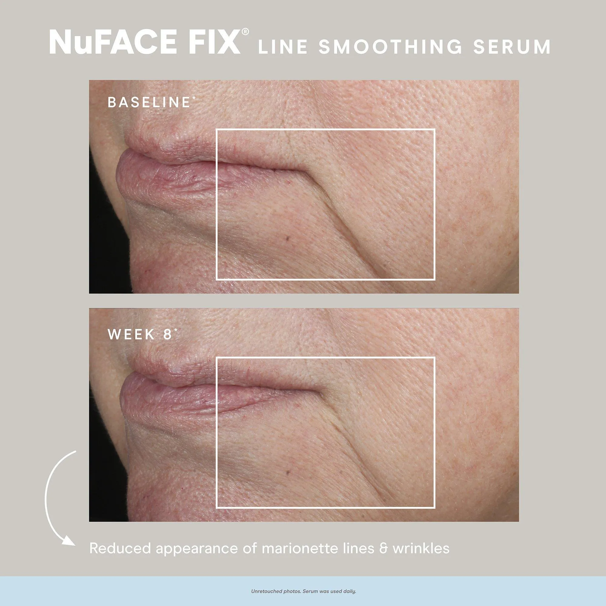NuFace Fix Smoothing Serum