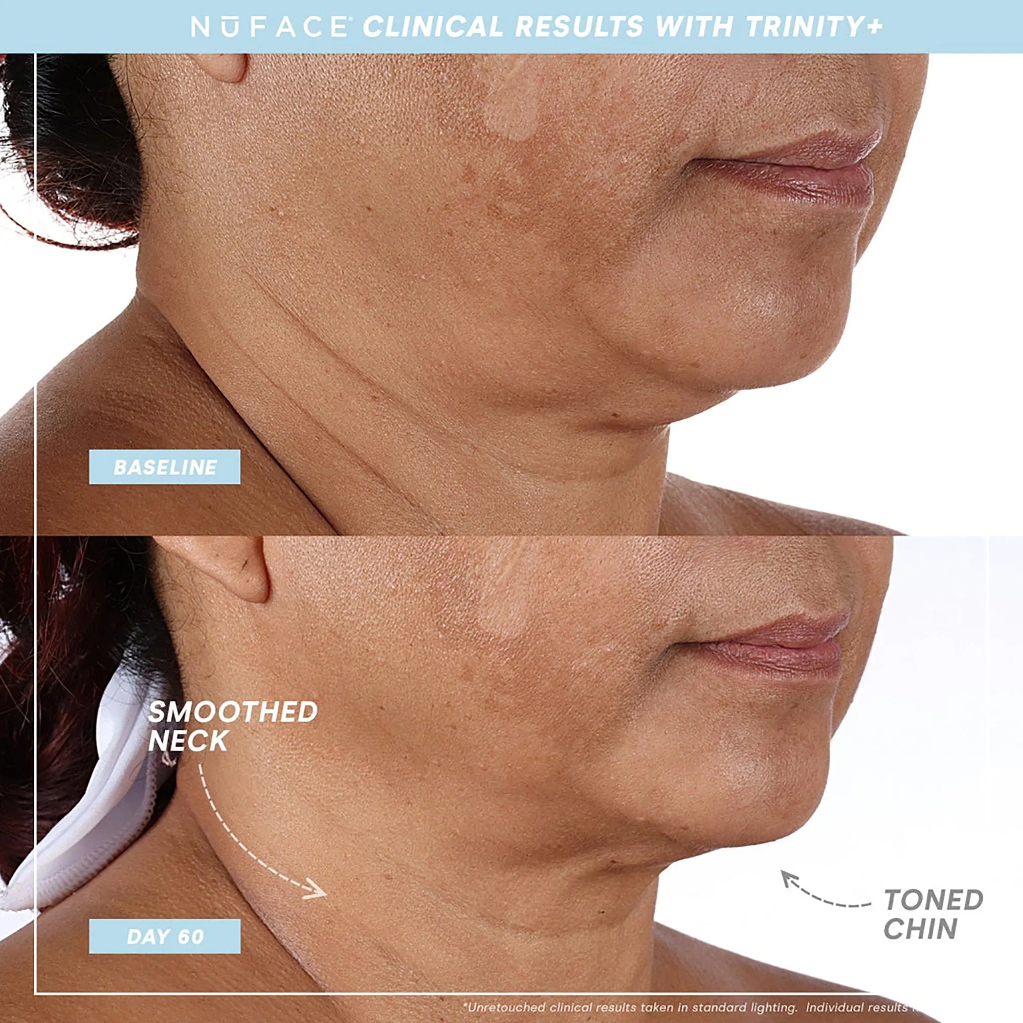 NuFace Trinity  WITH Effective Lip & Eye Attachment Kit