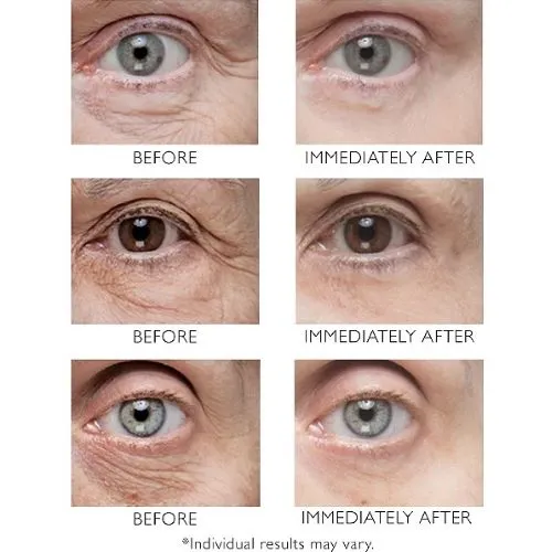 Peter Thomas Roth Instant FirmX Eye