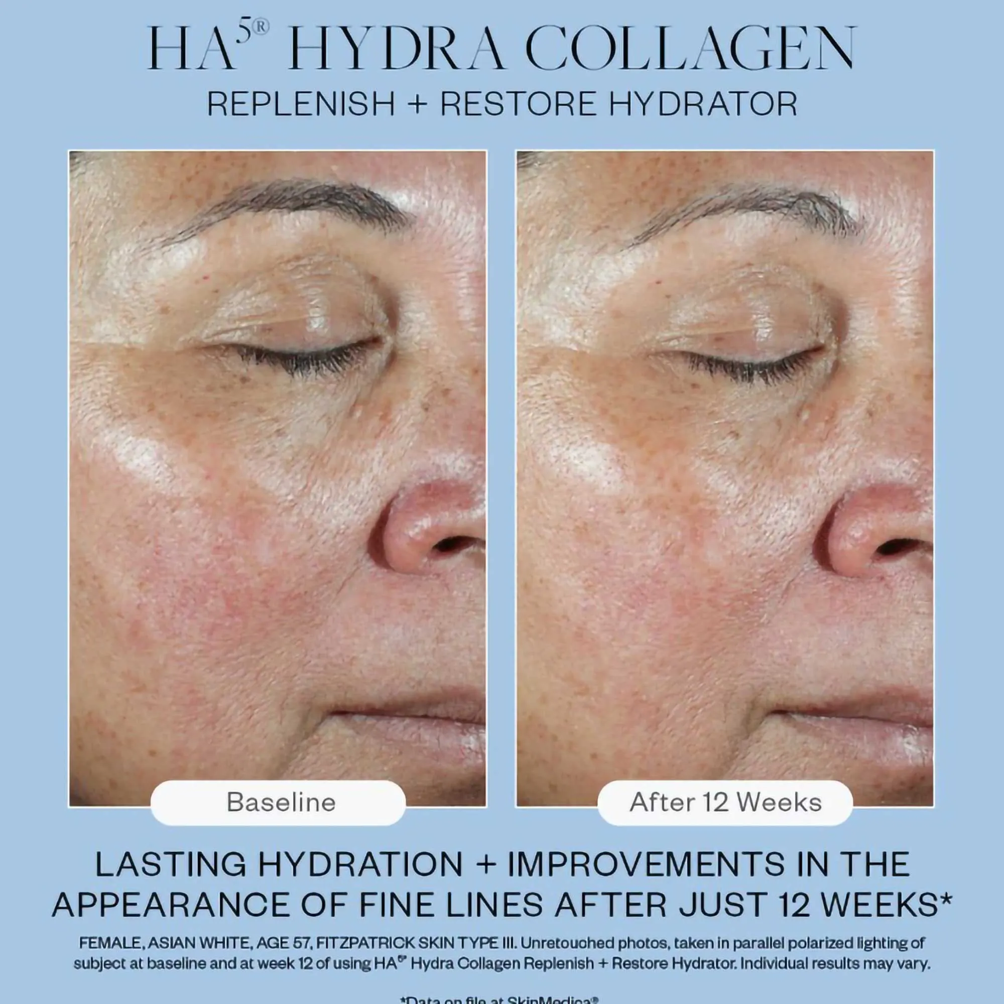 Skinmedica HA5 Hydra Collagen Replenish   Restore Hydrator