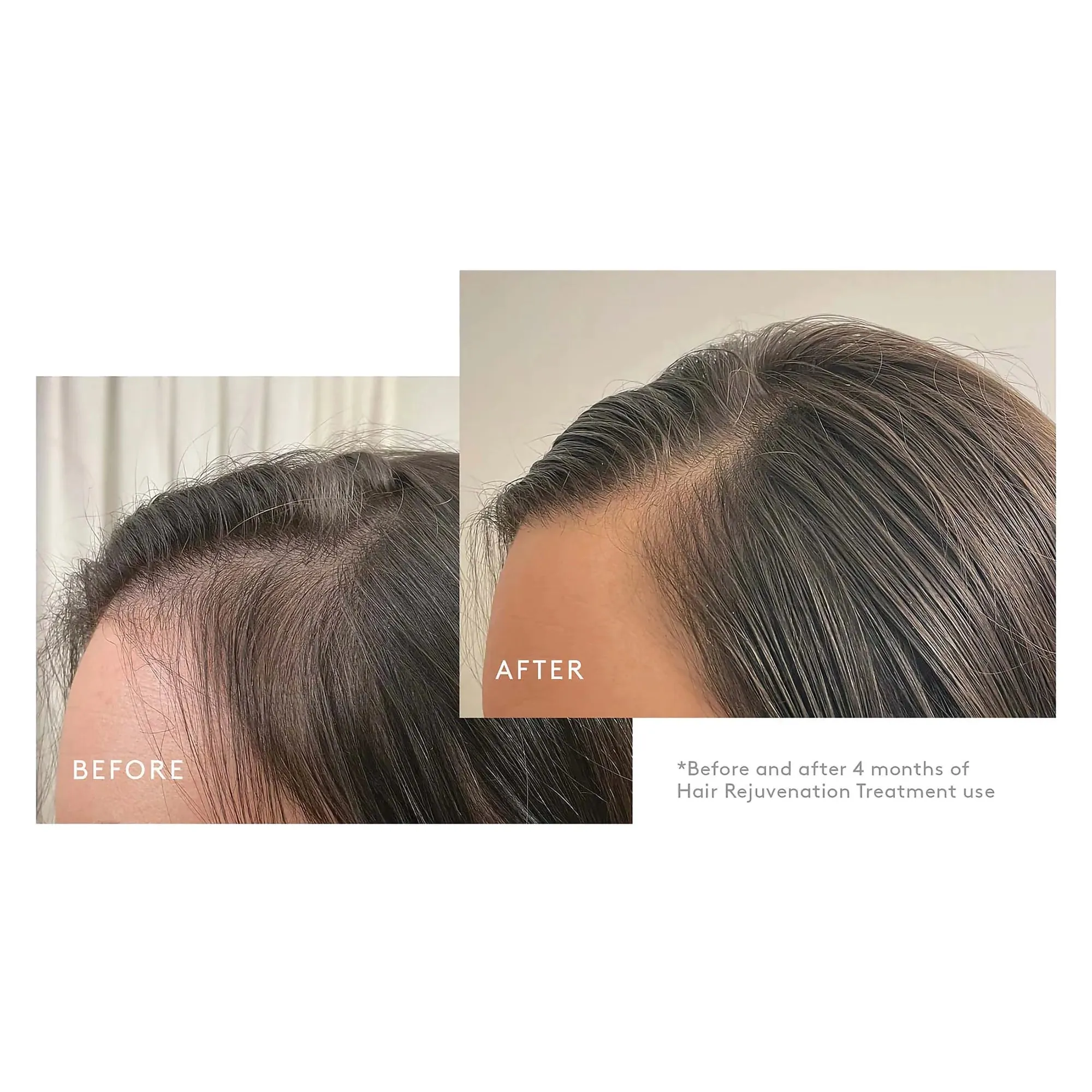Virtue Flourish Nightly Intensive Hair Rejuvenation Treatment Drug Free 90 Day
