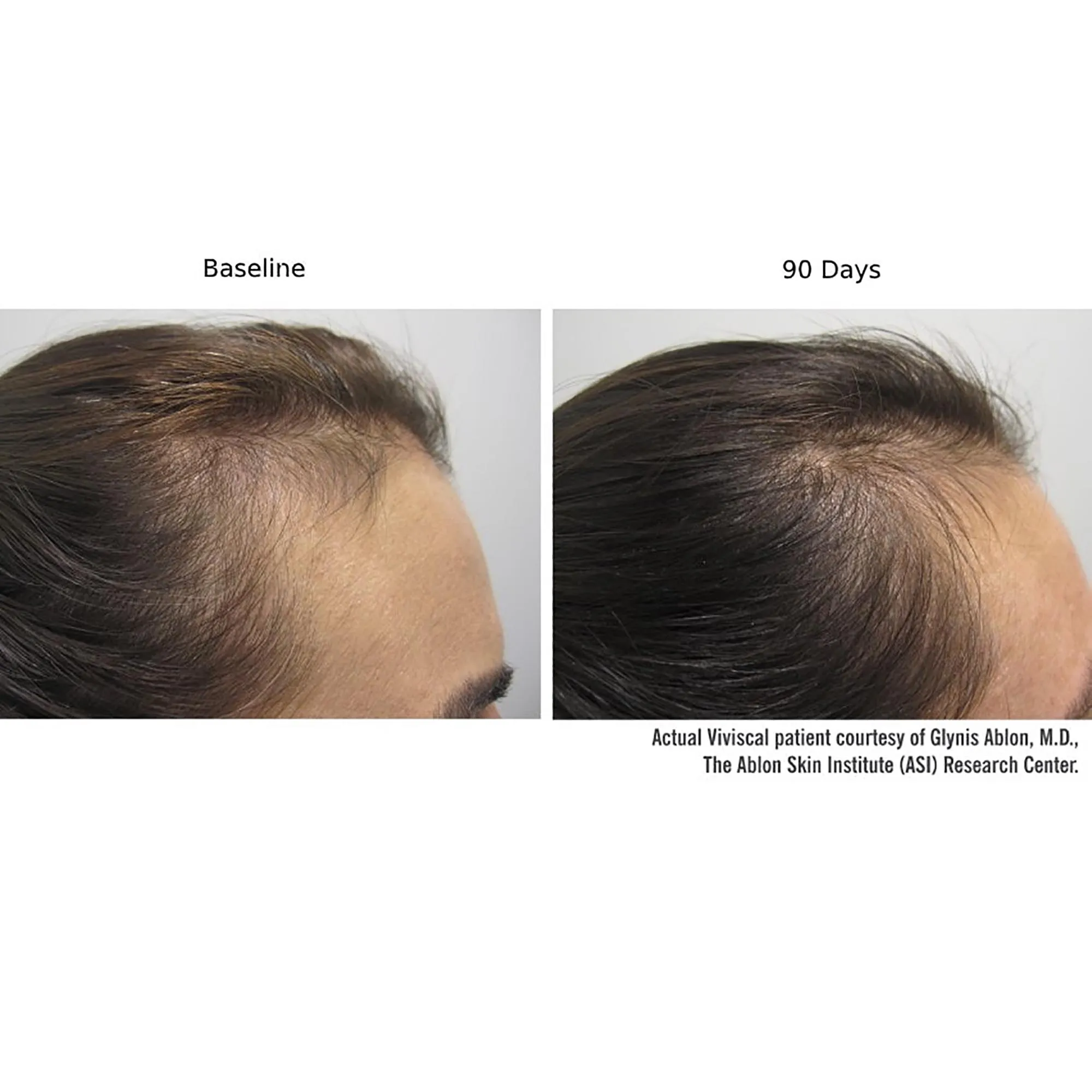 Viviscal Professional Advanced Hair Health Supplements