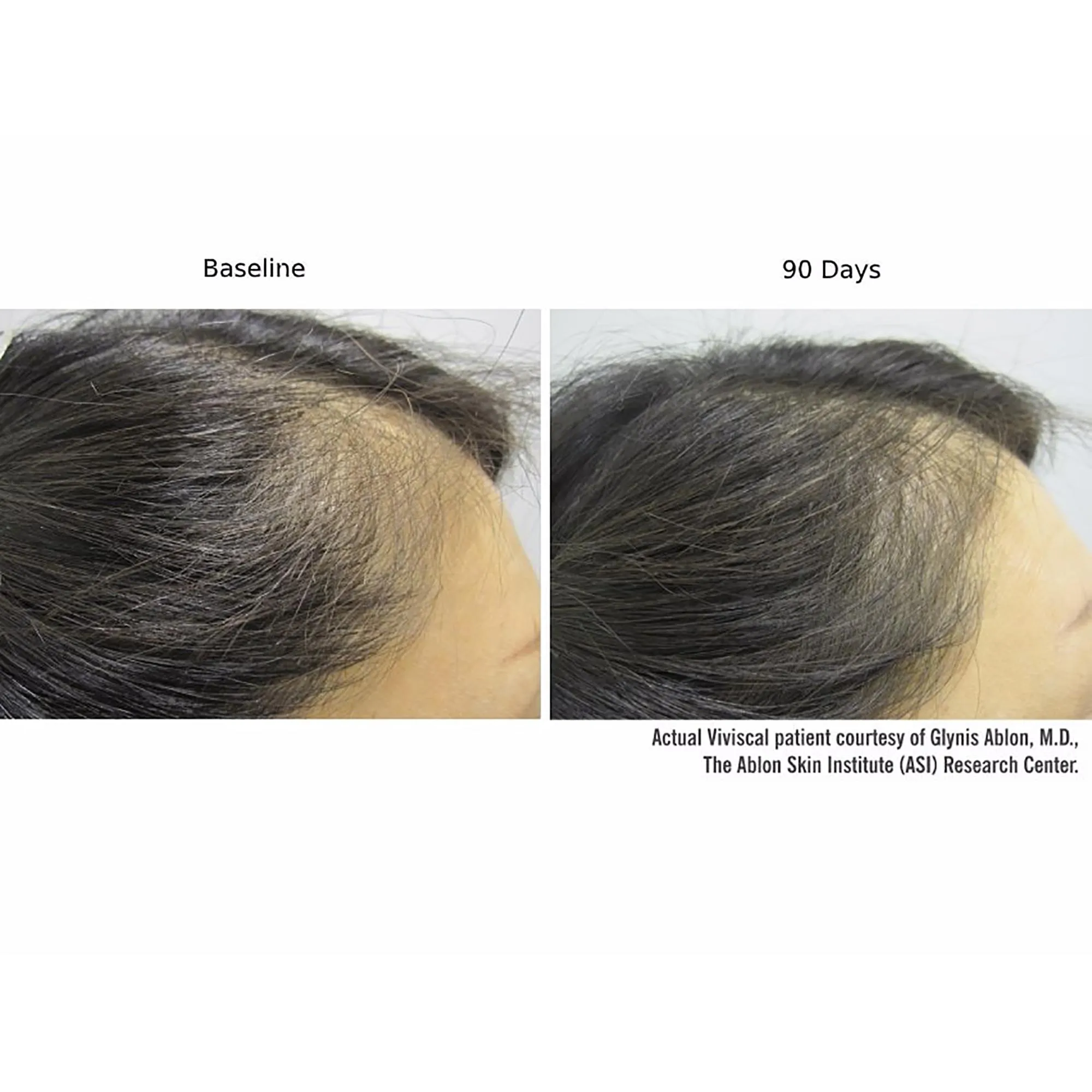 Viviscal Professional Advanced Hair Health Supplements