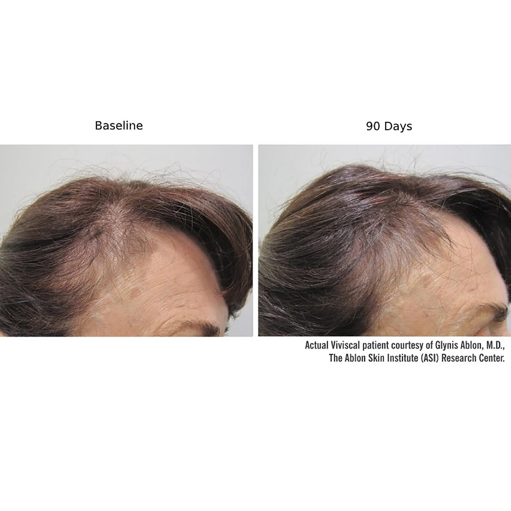 Viviscal Professional Advanced Hair Health Supplements